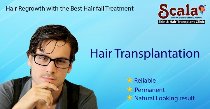 Hair Extensions in Hyderabad